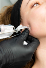 Mésothérapie 🍊💉