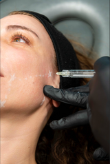 Skinboosters 💧💉