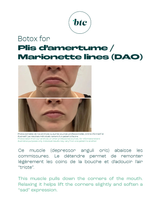 Injections anti-rides 💉