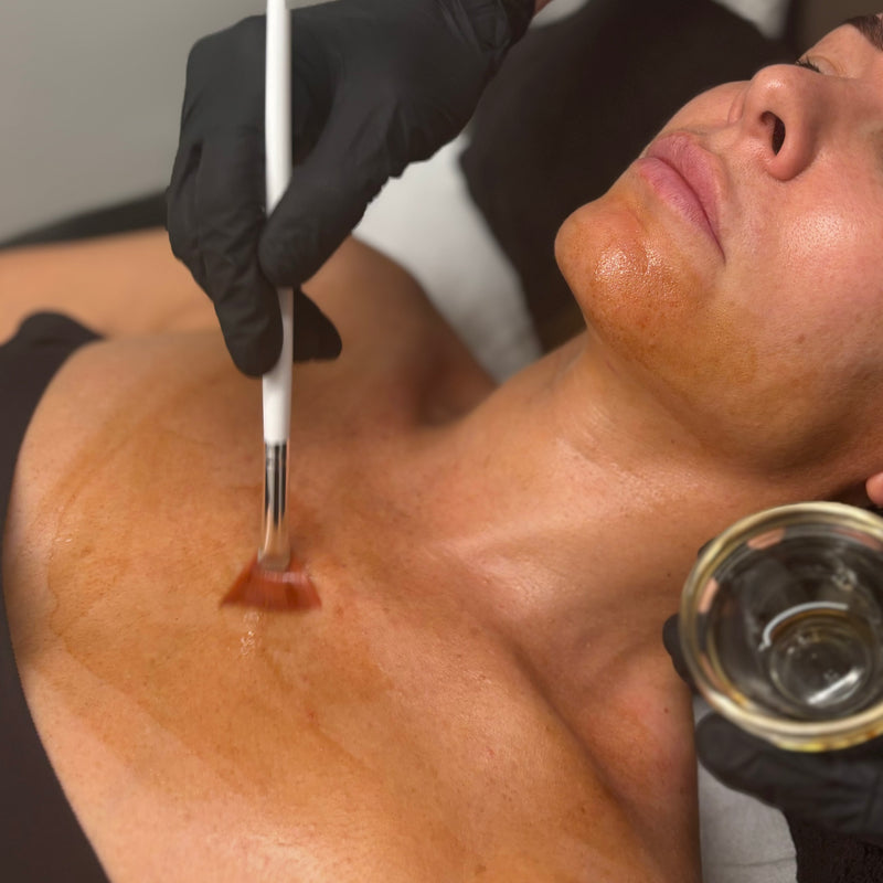 Peeling médical 🧪