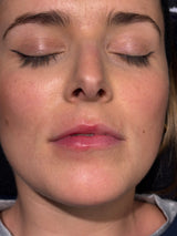 Hydrafacial® 🫧💧