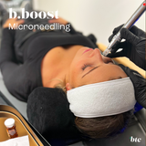 Microneedling