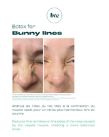 Injections anti-rides 💉