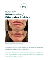 Injections anti-rides 💉