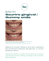 Injections anti-rides 💉