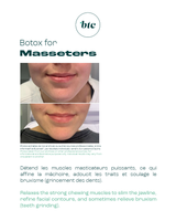 Injections anti-rides 💉