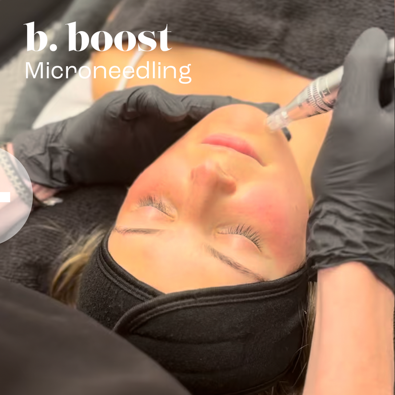 Big Booster (PRX-T33®+microneedling+LED)