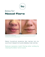 Injections anti-rides 💉