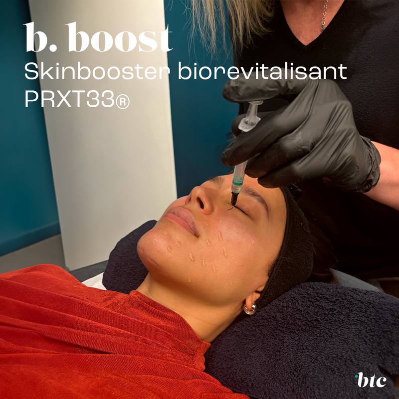 Skinbooster biorevitalisant PRXT33® (sans injections)