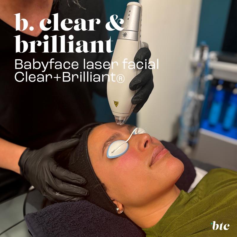 Babyface laser facial Clear+Brilliant®⚡️